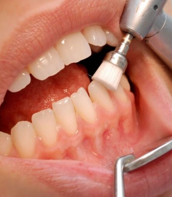 Periodoncia